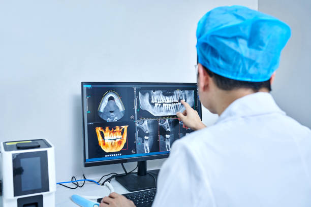 Best Emergency Tooth Extraction in Union City, GA