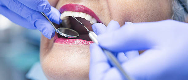 Best Emergency Broken Tooth Repair in Union City, GA